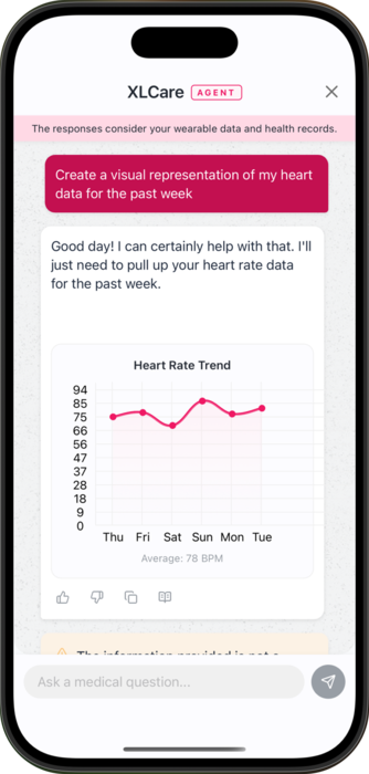 agent can create charts